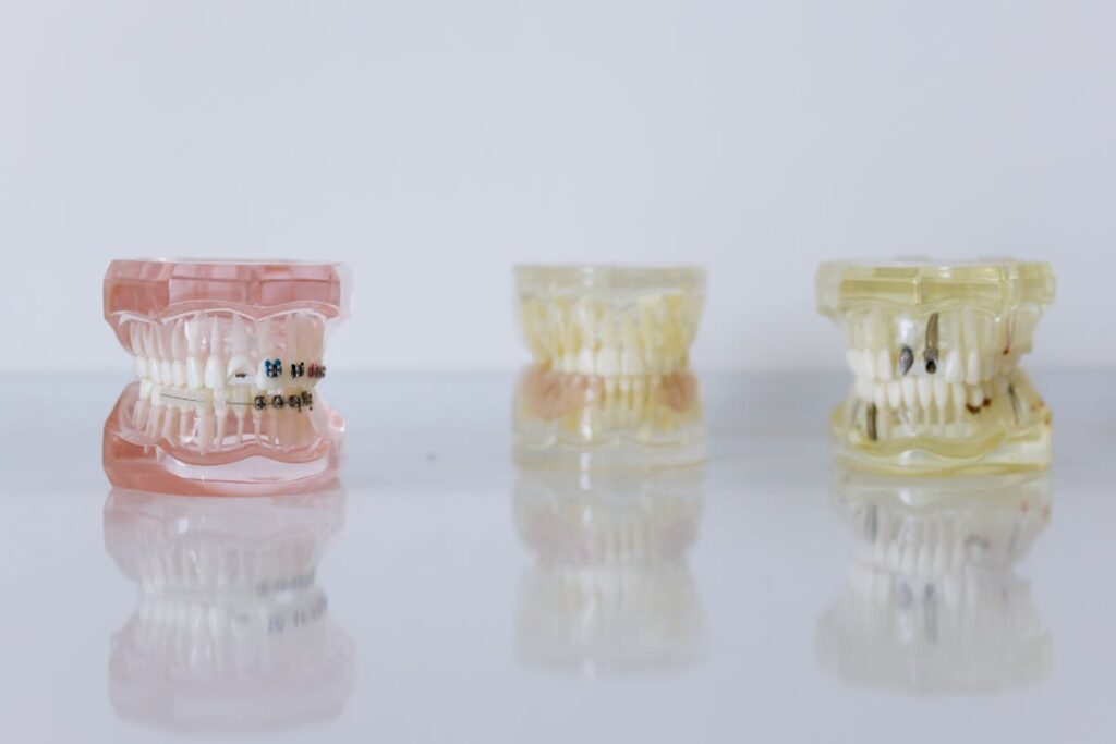 Dental Implants and Prostheses