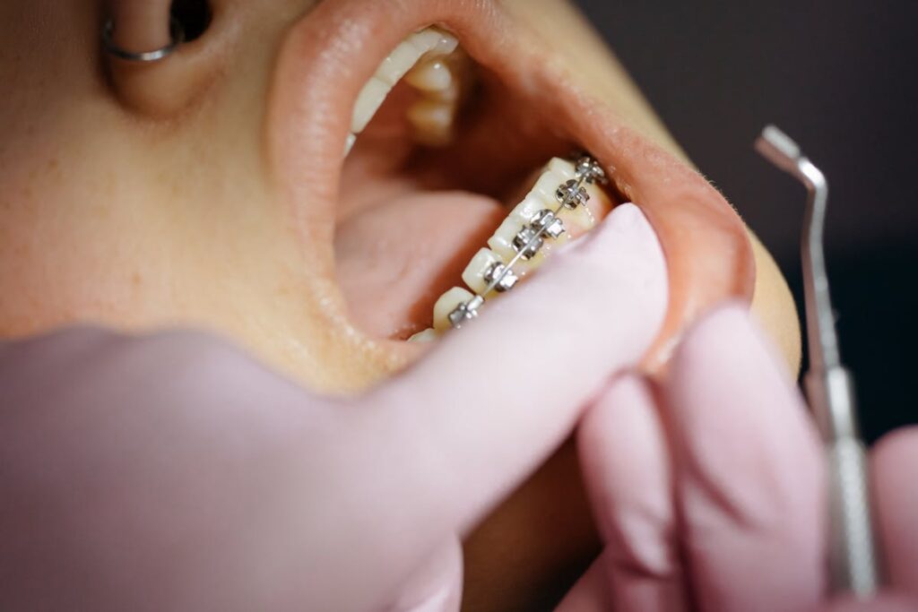 TMJTMD Treatment