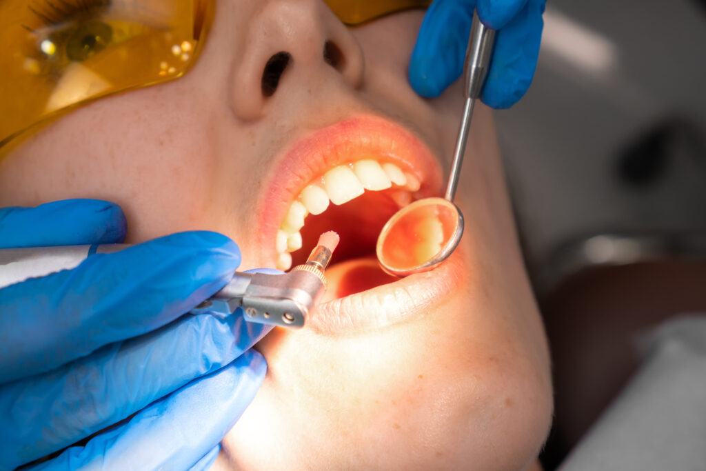 Female dentist removes tartar from her teeth.Visit is carried out in a professional dental clinic. Woman is sitting on a dental chair. Drilling and treatment of the tooth, filling.